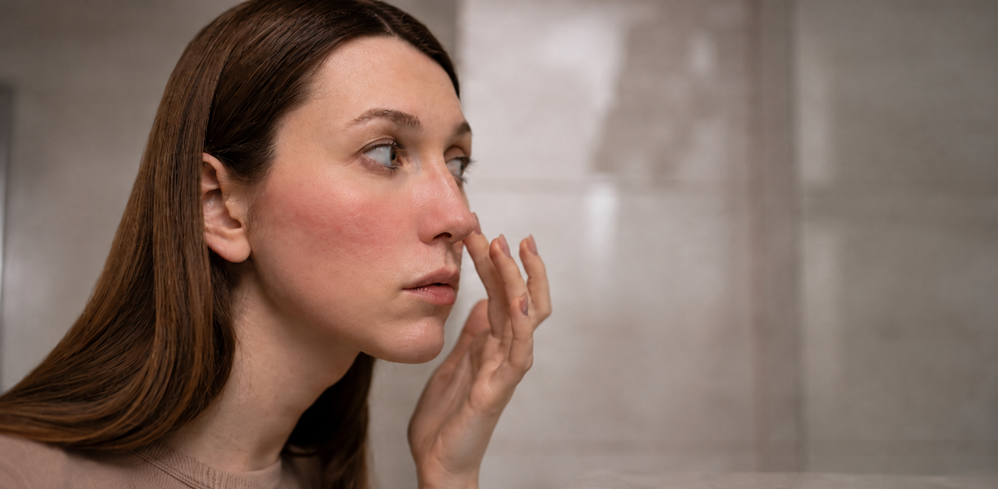 Woman with visible facial redness applying Omiana Redness Concealer Cream